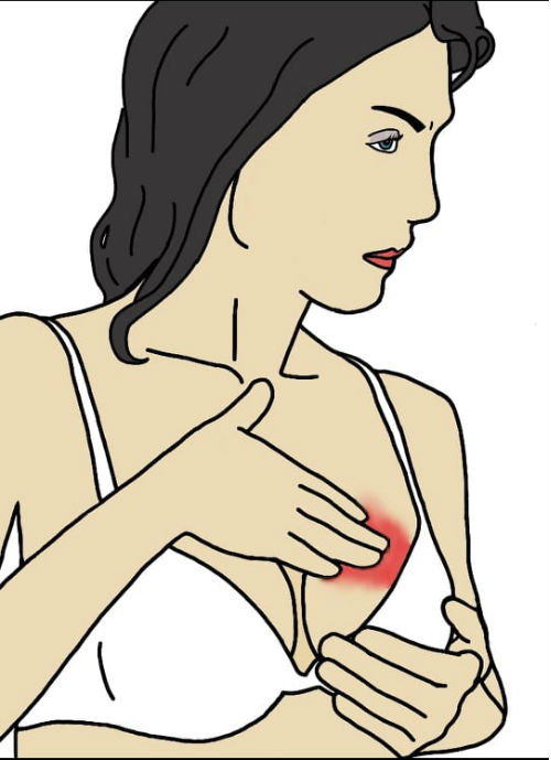 Как разбить комки при грудном вскармливании. Почему происходит уплотнение при установившейся лактации? Метод сцеживания при лактостазе